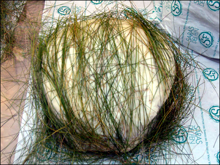 Sairas del fen